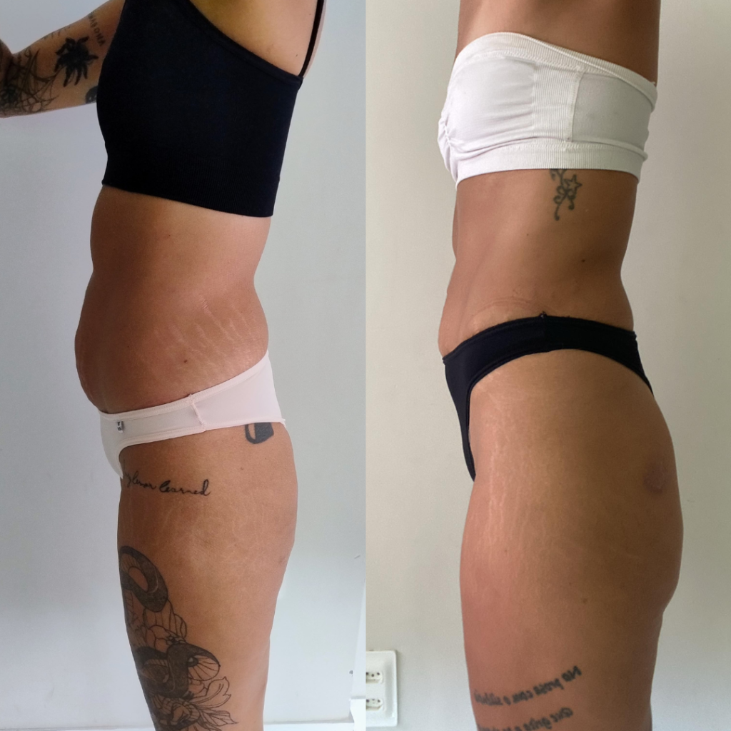 ANTES E DEPOIS (8)