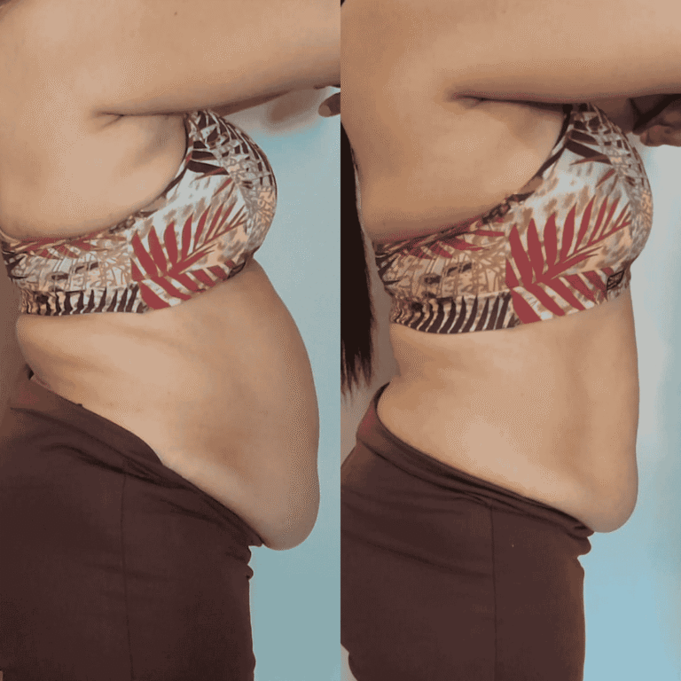 Antes e Depois (22)