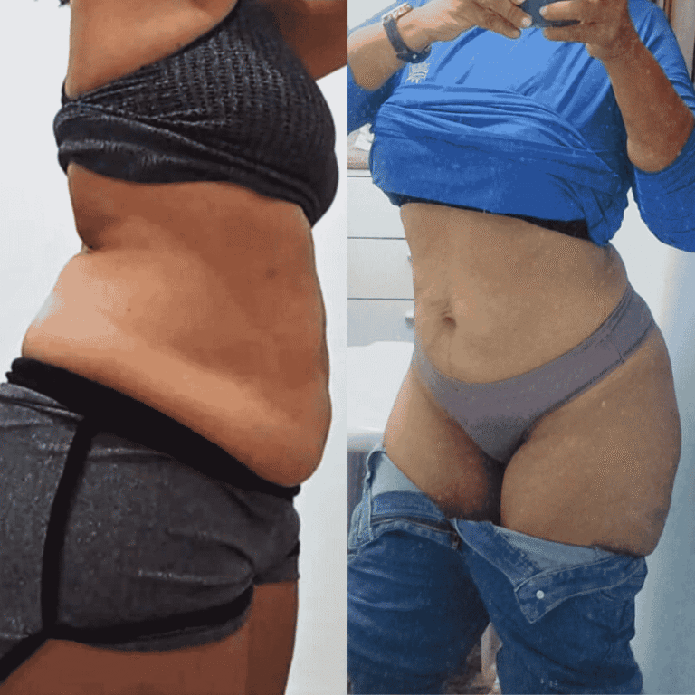 Antes e Depois (23)