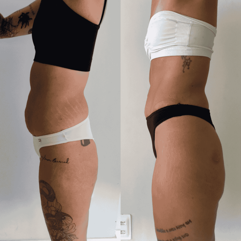 Antes e Depois (24)