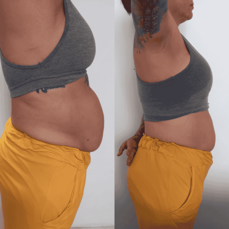 Antes e Depois (25)