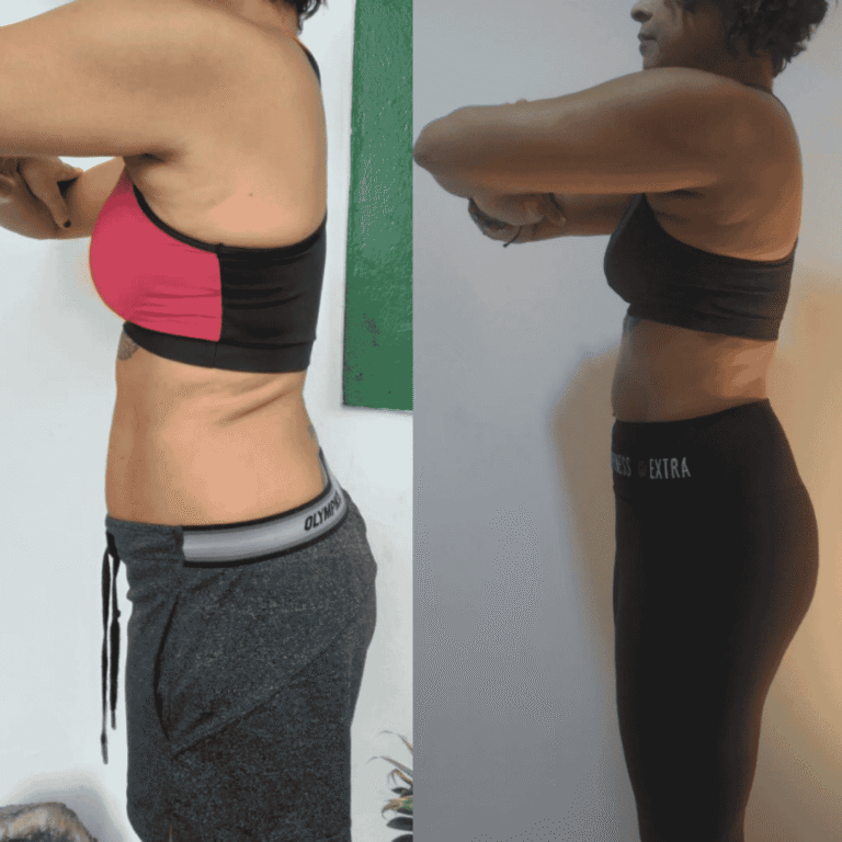 Antes e Depois (26)