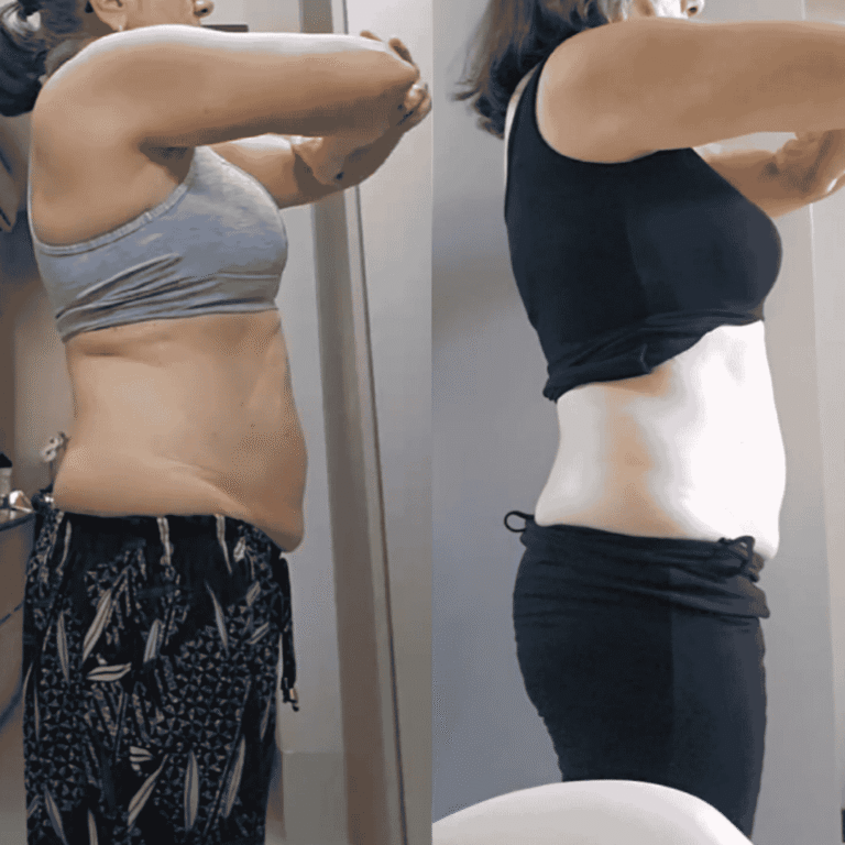 Antes e Depois (27)