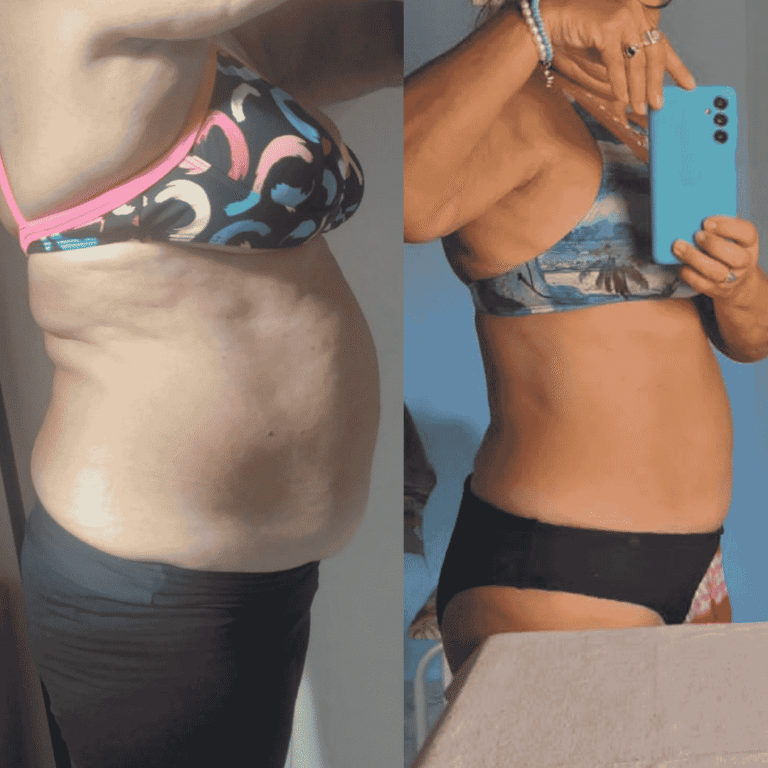 Antes e Depois (28)