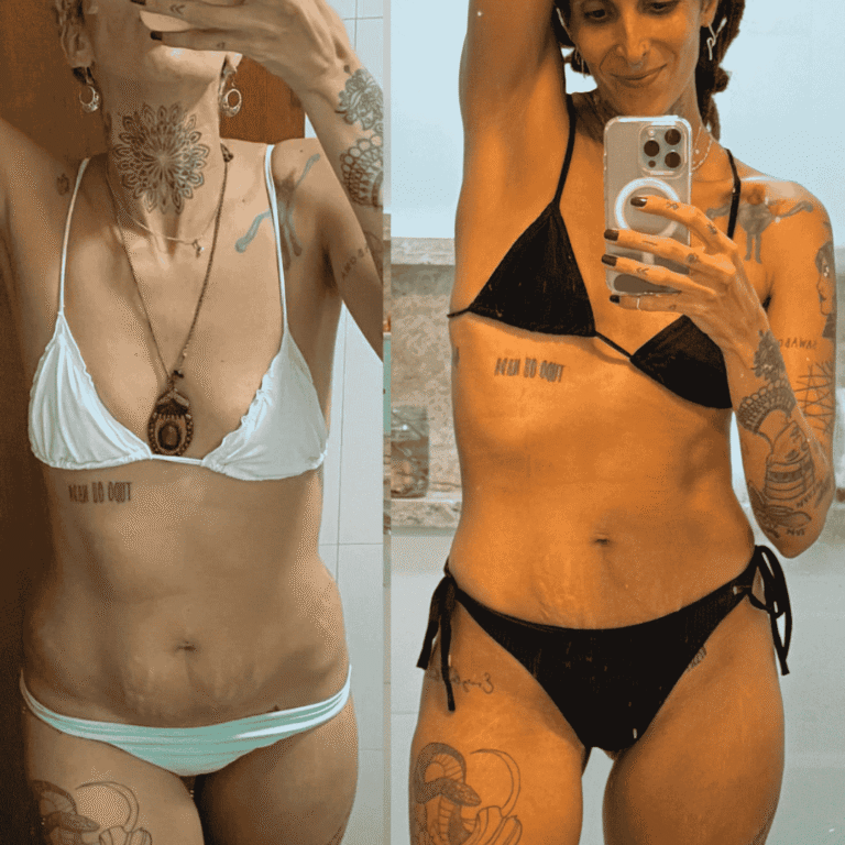 Antes e Depois (29)