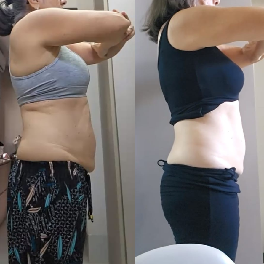 Antes e Depois walkiria